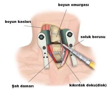 boyun-omurgasi