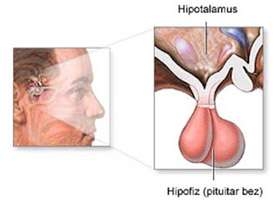 hipofiz-adenomu-02