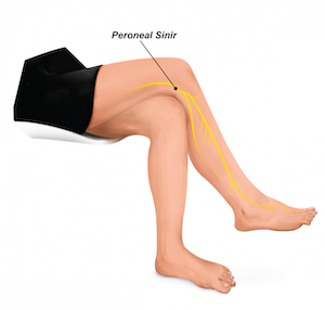 peroneal-sinir-dizin-arkasindaki-cukurda-siyatik-sinirden-ayrilir-ve-kaval-kemiginin-boynunun-cevresinde-doner-yuzeyel-ve-derin-olmak-uzere-iki-uc-dala-ayrilir