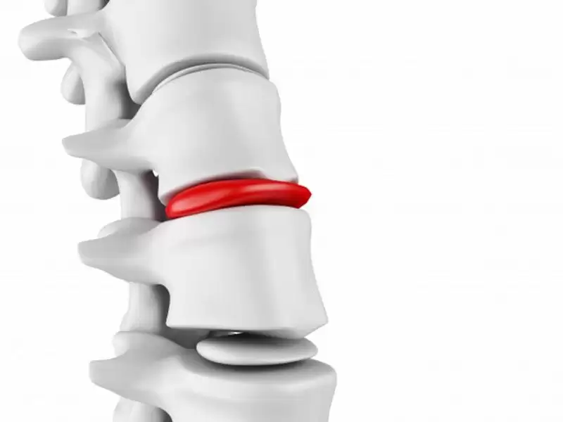 bel-fitiginda-uygulanan-ameliyat-yontemleri-nelerdir