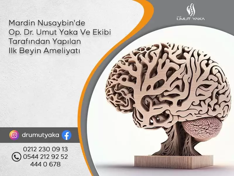 Op.,Dr.,Umut,Yaka,Nusaybin,Mardin,hastane,açık,beyin,ameliyatı