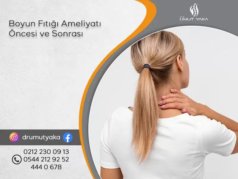 boyun fıtığı ameliyatı,boyun fıtığı ameliyatı öncesi ve sonrası,boyun fıtığı tedavisi,boyun fıtığı belirtileri,boyun fıtığı tanısı,boyun fıtığı doktoru,boyun fıtığı istanbul,mikrocerrahi yöntemi,kol uyuşması,kol güçs