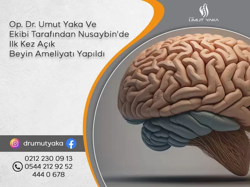 Op. Dr. Umut Yaka,Nusaybin,Mardin,hastane,açık,beyin,ameliyatı