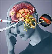 trigeminal-nevralji-1