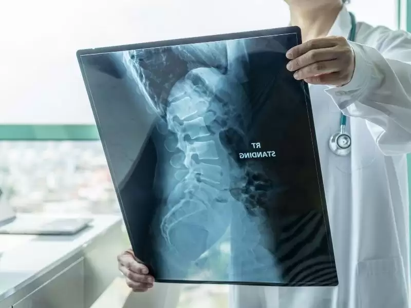 omurilik-tumoru-belirtileri